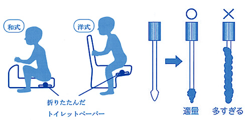 腸 内 細菌 検査